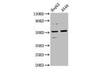 Western Blot<br />
Positive WB detected in:HepG2 whole cell lysate,A549 whole cell lysate<br />
All lanes:CPOX antibody at 5.7