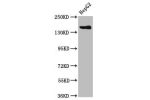 Western Blot<br />
Positive WB detected in:HepG2 whole cell lysate<br />
All lanes:CPS1 antibody at 3.8