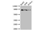 Western Blot<br />
Positive WB detected in:HepG2 whole cell lysate,A549 whole cell lysate,Mouse kidney tissue<br />
All lanes: CPT1A antibody at 3.4ug/ml<br />
Secondary<br />
Goat polyclonal to rabbit IgG at 1/50000 dilution<br />
Predicted band size: 89