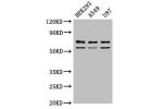 Western Blot<br />
Positive WB detected in:HEK293 whole cell lysate,A549 whole cell lysate,U87 whole cell lysate<br />
All lanes:CPZ antibody at 3
