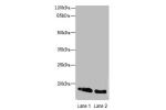 Western blot<br />
All lanes: Cellular retinoic acid-binding protein 1 antibody at 4ug/ml<br />
Lane 1 : NIH/3T3 whole cell lysate<br />
Lane 2 : Mouse ocular tissue<br />
Secondary<br />
Goat polyclonal to Rabbit IgG at 1/10000 dilution<br />
Predicted b