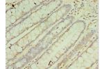 Immunohistochemistry of paraffin-embedded human rectum tissue using CSB-PA005938ESR1HU at dilution 1:100