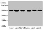 Western blot<br />
All lanes: CRHR1 antibody at 16ug/ml<br />
Lane 1 : Hela whole cell lysate<br />
Lane 2 : MCF7 whole cell lysate<br />
Lane 3 : Mouse brain tissue<br />
Lane 4 : Mouse liver tissue<br />
Lane 5 : HL60 whole cell lysate<br />
Lane 6 : K5