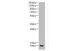 Western blot<br />
All lanes: CRIP1 antibody IgG at 1.44ug/ml+ PC-3 whole cell lysate<br />
Secondary<br />
Goat polyclonal to rabbit IgG at 1/10000 dilution<br />
Predicted band size: 9 kDa<br />
Observed band size: 9 kDa<br />