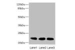 Western blot<br />
All lanes: CRIP2 antibody at 4.68ug/ml<br />
Lane 1 : Ret heart tissue<br />
Lane 2 : Mouse lung tissue<br />
Lane 3 : MCF7 whole cell lysate<br />
Secondary<br />
Goat polyclonal to rabbit IgG at 1/10000 dilution<br />
Predicted band s