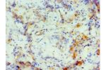 Immunohistochemistry of paraffin-embedded human testis using CSB-PA005975ESR2HU at dilution 1:100