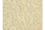 Immunohistochemistry of paraffin-embedded human liver tissue CSB-PA005983ESR1HU at dilution 1:100