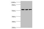 Western blot<br />
All lanes:CRNN antibody at 12ug/ml<br />
Lane 1:HepG2 whole cell lysate<br />
Lane 2:Mouse heart tissue<br />
Lane 3:rat skeletal muscle tissue<br />
Secondary<br />
Goat polyclonal to rabbit at 1/10000 dilution<br />
Predicted band siz