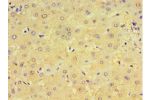 Immunohistochemistry of paraffin-embedded human liver using CSB-PA006004DSR1HU at dilution 1:100