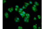 Immunofluorescence staining of HepG2 cells with CSB-PA006007LA01HU at 1:66,counter-stained with DAPI. The cells were fixed in 4% formaldehyde, permeabilized using 0.2% Triton X-100 and blocked in 10% normal Goat Serum. The cells were then incubated with t