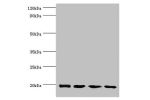 Western blot<br />
All lanes:Alpha-crystallin B chain antibody at 2ug/ml<br />
Lane 1:293T whole cell lysate<br />
Lane 2:mouse eye tissue<br />
Lane 3:rat lung tissue<br />
Lane 4:rat heart tissue<br />
Secondary<br />
Goat polyclonal to rabbit at 1/1000