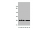 Western blot<br />
All lanes: CRYBA1 antibody at 6ug/ml<br />
Lane 1 : Mouse heart tissue<br />
Lane 2 : Human placenta tissue<br />
Lane 3 : U251 whole cell lysate<br />
Lane 4 : U937 whole cell lysate<br />
Lane 5 : Mouse stomach tissue<br />
Lane 6 : M