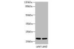 Western blot<br />
All lanes: CRYBA4 antibody at 0.1ug/ml<br />
Lane 1 : Hela whole cell lysate<br />
Lane 2 : Human placenta tissue<br />
Secondary<br />
Goat polyclonal to Rabbit IgG at 1/10000 dilution<br />
Predicted band size: 22 kDa<br />
Observed b