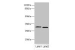 Western blot<br />
All lanes: