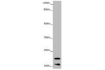 Western blot<br />
All lanes:CRYGS antibody at 6.87 ug/ml<br />
 + Mouse eye tissue<br />
Secondary<br />
Goat polyclonal to rabbit IgG at 1/10000 dilution<br />
Predicted band size: 21 kDa<br />
Observed band size: 21,23 kDa<br />