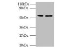 All lanes: Citrate synthase, mitochondrial antibody at 2ug/ml<br />
Lane 1 : Hela whole cell lysate<br />
Lane 2 : HepG2 whole cell lysate<br />
Secondary<br />
Goat polyclonal to Rabbit IgG at 1/10000 dilution<br />
Predicted band size: 52kDa<br />
Obser