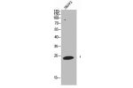 Western Blot analysis of SKOV3 cells using CD63 Polyclonal Antibody