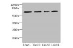 Western blot<br />
All lanes: CSGALNACT2 antibody at 4ug/ml<br />
Lane 1 : K562 whole cell lysate<br />
Lane 2 : 293T whole cell lysate<br />
Lane 3 : Jurkat whole cell lysate<br />
Lane 4 : PC-3 whole cell lysate<br />
Secondary<br />
Goat polyclonal to 