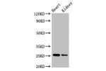Western Blot<br />
Positive WB detected in:Mouse heart tissue,Mouse kidney tissue<br />
All lanes:CSH2 antibody at 4