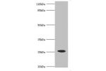 Western blot<br />
All lanes:CSHL1 antibody at 2ug/ml+mouse placenta tissue<br />
Secondary<br />
Goat polyclonal to rabbit at 1/10000 dilution<br />
Predicted band size: 26,23,16,15 kDa<br />
Observed band size: 25 kDa<br />