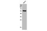 Western Blot analysis of SKOV3 cells using CD292 Polyclonal Antibody