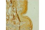 Immunohistochemistry of paraffin-embedded human skin tissue using CSB-PA006065LA01HU at dilution 1:100