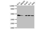 Western Blot<br />
Positive WB detected in:Hela whole cell lysate,HEK293 whole cell lysate,HepG2 whole cell lysate,Raji whole cell lysate,K562 whole cell lysate<br />
All lanes:CSNK2A1 antibody at 3