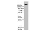 Western blot<br />
All lanes: CSPG4 antibody IgG at 2.51ug/ml+ A375 whole cell lysate<br />
Secondary<br />
Goat polyclonal to rabbit IgG at 1/10000 dilution<br />
Predicted band size: 251 kDa<br />
Observed band size: 251 kDa<br />