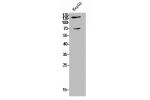 Western Blot analysis of HepG2 cells using COL5A2 Polyclonal Antibody