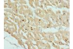 Immunohistochemistry of paraffin-embedded Human heart tissue using CSB-PA006087ESR1HU at dilution 1:100