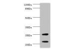 Western blot<br />
All lanes:CSRP3 antibody at 1ug/ml+mouse skeletal muscle tissue<br />
Secondary<br />
Goat polyclonal to rabbit at 1/10000 dilution<br />
Predicted band size: 21kDa<br />
Observed band size: 21kDa,25kDa<br />