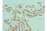 Immunohistochemistry of paraffin-embedded human prostate using CSB-PA006088ESR1HU at dilution 1:100