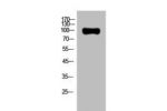 Western Blot analysis of Hela cells using AR Polyclonal Antibody.
