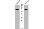 Western Blot analysis of HepG2-UV cells using Cortactin Polyclonal Antibody