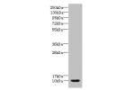 Western blot<br />
All lanes: CSTA antibody at 10ug/ml+ A431 whole cell lysate<br />
Goat polyclonal to rabbit at 1/10000 dilution<br />
Predicted band size: 11 kDa<br />
Observed band size: 11 kDa<br />
