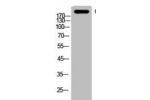 Western Blot analysis of AD293 cells using C4a/b Polyclonal Antibody.