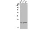 Western Blot analysis of 293T Hela 823 cells using ANG I Polyclonal Antibody