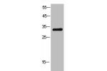 Western Blot analysis of K562 cells using FGF-2 Polyclonal Antibody.