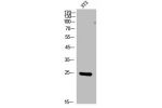 Western Blot analysis of NIH-3T3 cells using FGF-17 Polyclonal Antibody