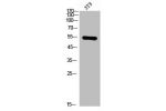 Western Blot analysis of NIH-3T3 cells using AChRa1 Polyclonal Antibody