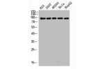 Western Blot analysis of 823 293T AD293 Hela HepG2 cells using NOXIN Polyclonal Antibody
