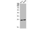 Western Blot analysis of Hela HepG2 cells using AID Polyclonal Antibody