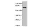 Western blot<br />
All lanes: Ctcfl antibody at 6ug/ml+Hela whole cell lysate<br />
Goat polyclonal to rabbit at 1/10000 dilution<br />
Predicted band size: 74,75 kDa<br />
Observed band size: 73 kDa<br />