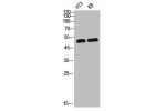 Western Blot analysis of NIH-3T3 KB cells using GABAA Ra1 Polyclonal Antibody