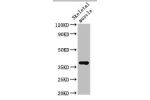 Western Blot<br />
Positive WB detected in:Rat skeletal muscle tissue<br />
All lanes:Ctgf antibody at 3