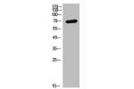 Western Blot analysis of SKOV3 cells using GHR Polyclonal Antibody.