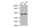 Western Blot<br />
Positive WB detected in:Rat heart tissue,Mouse brain tissue<br />
All lanes:CTH antibody at 4