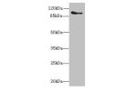 Western blot<br />
All lanes:CTNNA1 antibody at 8ug/ml+mouse brain tissue<br />
Secondary<br />
Goat polyclonal to rabbit at 1/10000 dilution<br />
Predicted band size: 101,103,60 kDa<br />
Observed band size: 100 kDa<br />