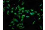 Immunofluorescence staining of Hela cells with CSB-PA006165LA01HU at 1:133, counter-stained with DAPI. The cells were fixed in 4% formaldehyde, permeabilized using 0.2% Triton X-100 and blocked in 10% normal Goat Serum. The cells were then incubated with 