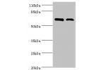 Western blot<br />
All lanes:CTPS1 antibody at 6ug/ml<br />
Lane 1:Hela cells<br />
Lane 2:293T cells<br />
Secondary<br />
Goat polyclonal to rabbit at 1/10000 dilution<br />
Predicted band size: 67,42 kDa<br />
Observed band size: 67 kDa<br />